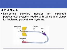 Image result for Needle Port in Hand