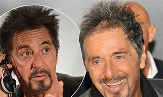 Image result for Al Pacino Facelift