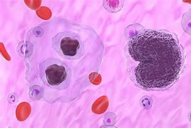 Image result for Lymphoma Panel