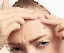 Image result for Pimples to Non Pimples