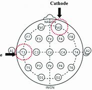 Image result for tDCS Placement Map