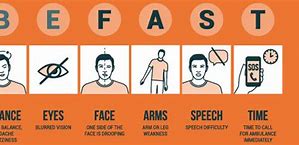 Image result for Be Fast Acronym Image