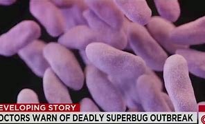 Image result for Sporadic Outbreak CRE