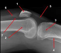 Image result for Normal Lateral Knee Radiograph