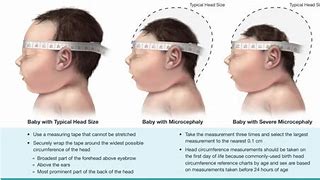 Image result for Head Circumference 37 Weeks Ultrasound