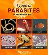 Image result for Parasitic Worms