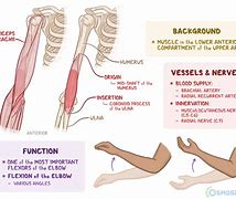 Image result for Selective Catheter Placement From Brachial Approach