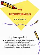 Image result for Hydrocephalus Concept Map