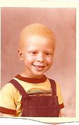 Image result for Child Boy Albino