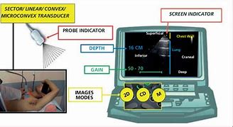 Image result for Lung Ultrasound Probe