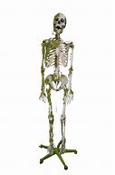 Image result for Moss-Covered Skeleton