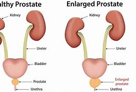 Image result for Shape of Prostate