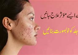 Image result for How to Get Rid Acne Bumps