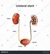 Image result for Ureter Blood Supply