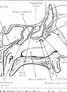 Image result for Infundibulum Nose