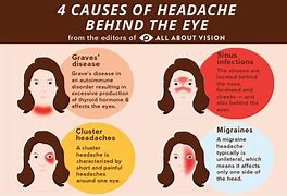 Image result for Headache Left Side of Head