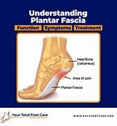 Image result for Plantar Fascia Ligament Pain