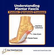 Image result for Mechanics of Plantar Fascia