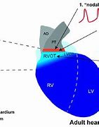 Image result for Rvot Heart Anatomy