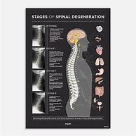 Image result for Spinal Nerve Innervation Chart