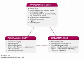 Image result for Sessile Thrombus