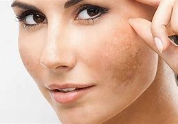 Image result for Skin Darkening