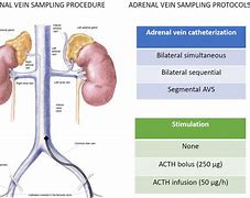 Image result for Adrenal Artery