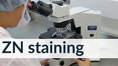 ZN Staining technique | Microbiology