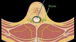 Spinal nerves