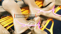 Medial Branch Nerve Blocks