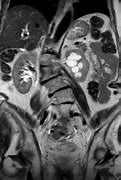 Image result for IRM Abdominal