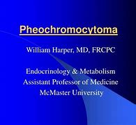 Image result for Pheochromocytoma Presentation