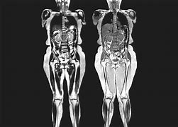 Image result for Full-Body CT Scan