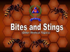 Image result for Bites and Stings Nursing PPT