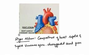 Image result for Myocardium of Interventricular Septum