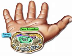 Image result for Flexor Retinaculum of the Hand Function