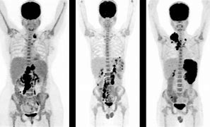 Image result for PET/CT For