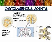 Image result for Examples of Cartilaginous Joints