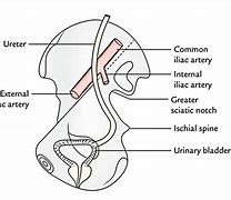 Image result for Abdominal Ureter