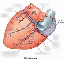 Image result for Posterior Interventricular Sulcus