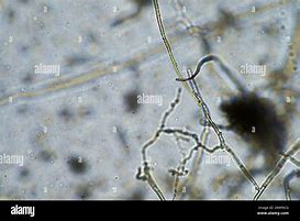 Image result for Fungi without Hyphae