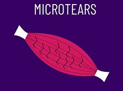 Image result for Micro Tears in Muscle Fiber Under Microscopes