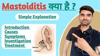 Image result for Mastoiditis