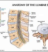 Image result for L5 Lumbar Vertebrae