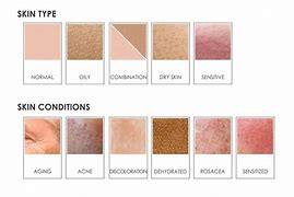 Image result for Skin Table Chart