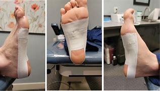 Image result for Plantar Arch of Foot