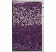 Image result for Adrenal Cortex Histology