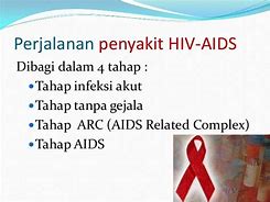 Image result for HIV Dan Aids