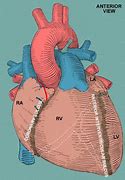 Image result for Posterior Interventricular Sulcus