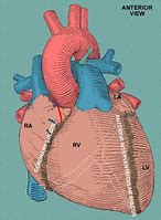 Image result for Atrioventricular Coronary Sulcus